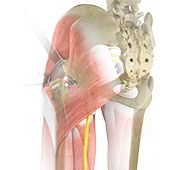 Complex Hip Reconstruction Surgery